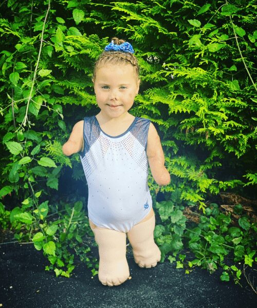 6-year-old girl, who lost her limbs to meningitis at 9-months-old, learns gymnastics.